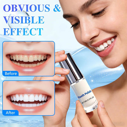 Tooth Polisher — Instantly Whiter Smile🦷